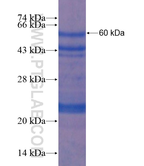 ZNF366 fusion protein Ag19591 SDS-PAGE