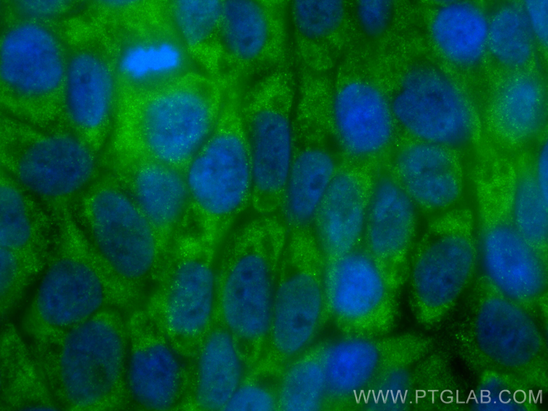 Immunofluorescence (IF) / fluorescent staining of HaCaT cells using ZNF385A Polyclonal antibody (26288-1-AP)