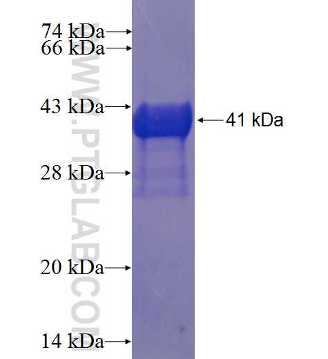 ZNF385A fusion protein Ag23577 SDS-PAGE