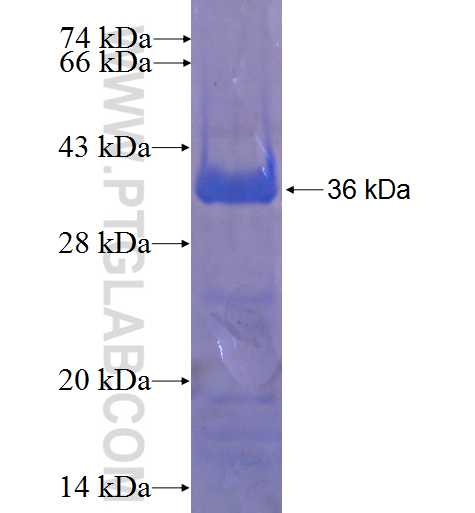 ZNF394 fusion protein Ag22656 SDS-PAGE