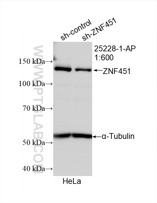 Western Blot (WB) analysis of HeLa cells using ZNF451 Polyclonal antibody (25228-1-AP)