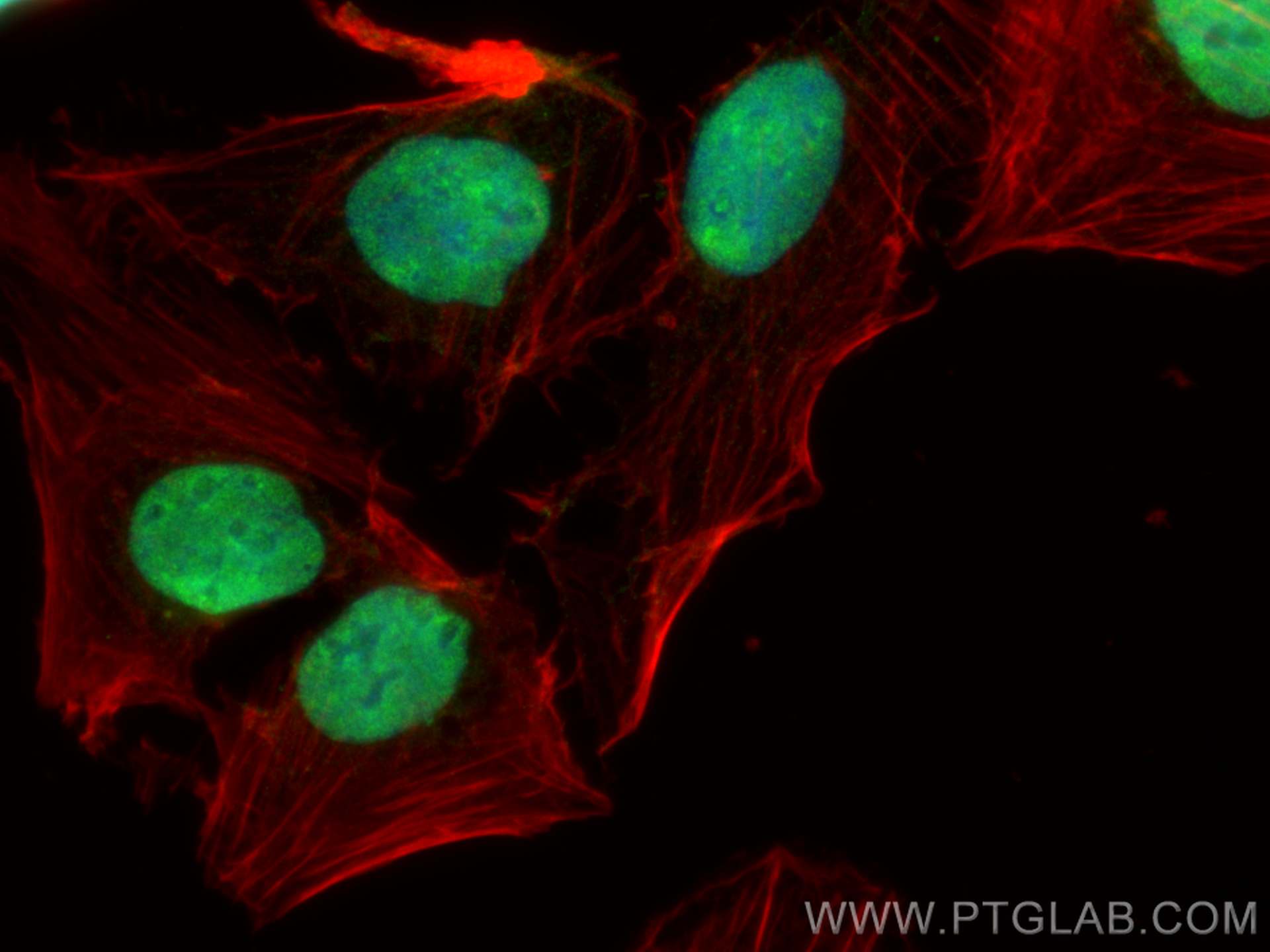 Immunofluorescence (IF) / fluorescent staining of U2OS cells using ZNF470 Polyclonal antibody (26134-1-AP)