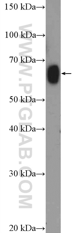 Western Blot (WB) analysis of rat testis tissue using ZNF470 Polyclonal antibody (26134-1-AP)