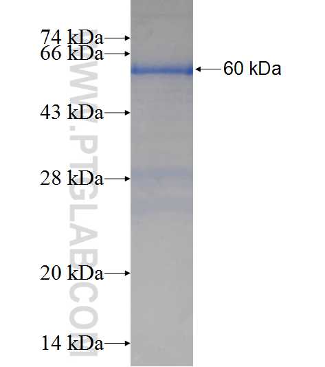 ZNF473 fusion protein Ag23984 SDS-PAGE