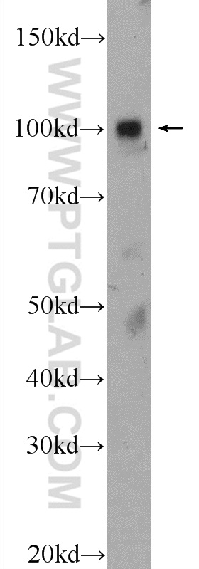 Western Blot (WB) analysis of fetal human brain tissue using ZNF483 Polyclonal antibody (25242-1-AP)