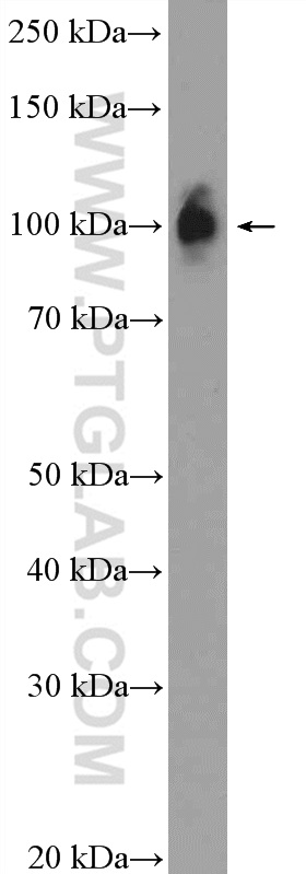 Western Blot (WB) analysis of fetal human brain tissue using ZNF483 Polyclonal antibody (25242-1-AP)