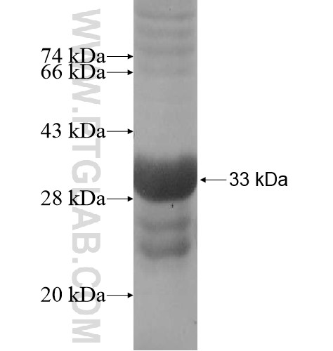 ZNF493 fusion protein Ag14577 SDS-PAGE