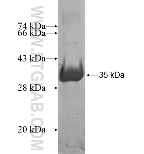 ZNF511 fusion protein Ag15261 SDS-PAGE