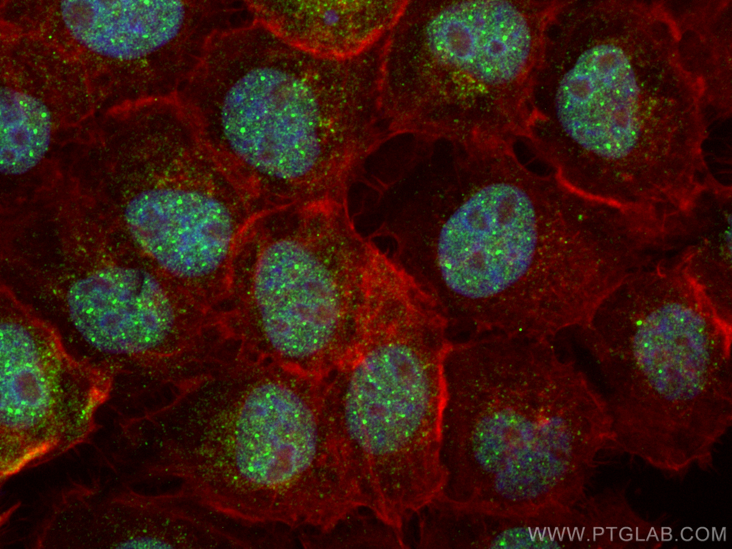 Immunofluorescence (IF) / fluorescent staining of A431 cells using ZNF521 Polyclonal antibody (23716-1-AP)