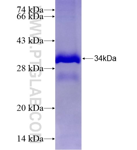 ZNF559 fusion protein Ag28258 SDS-PAGE