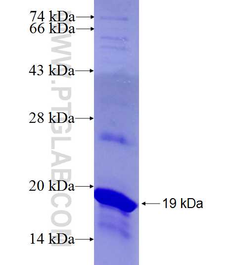 ZNF567 fusion protein Ag27017 SDS-PAGE