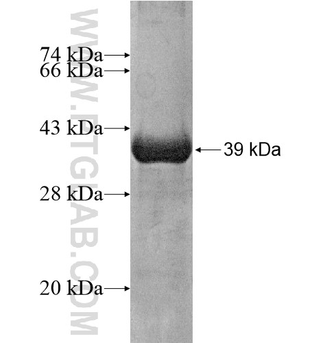 ZNF57 fusion protein Ag15252 SDS-PAGE