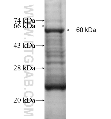 ZNF574 fusion protein Ag13872 SDS-PAGE