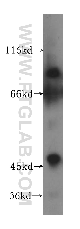 Western Blot (WB) analysis of Jurkat cells using ZNF611 Polyclonal antibody (17249-1-AP)