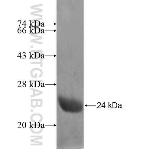 ZNF614 fusion protein Ag14991 SDS-PAGE