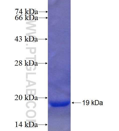 ZNF641 fusion protein Ag23763 SDS-PAGE