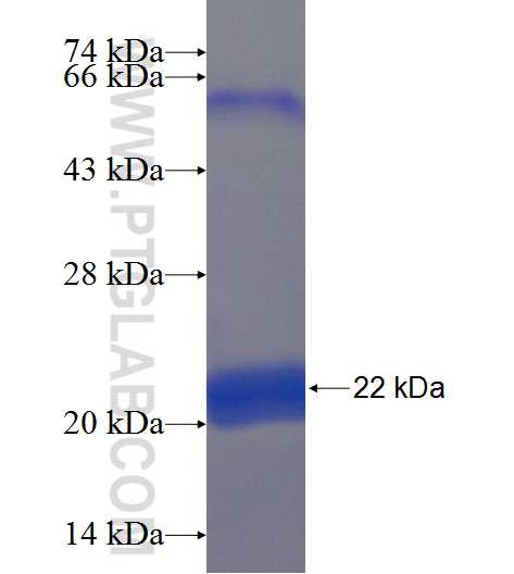 ZNF649 fusion protein Ag22852 SDS-PAGE