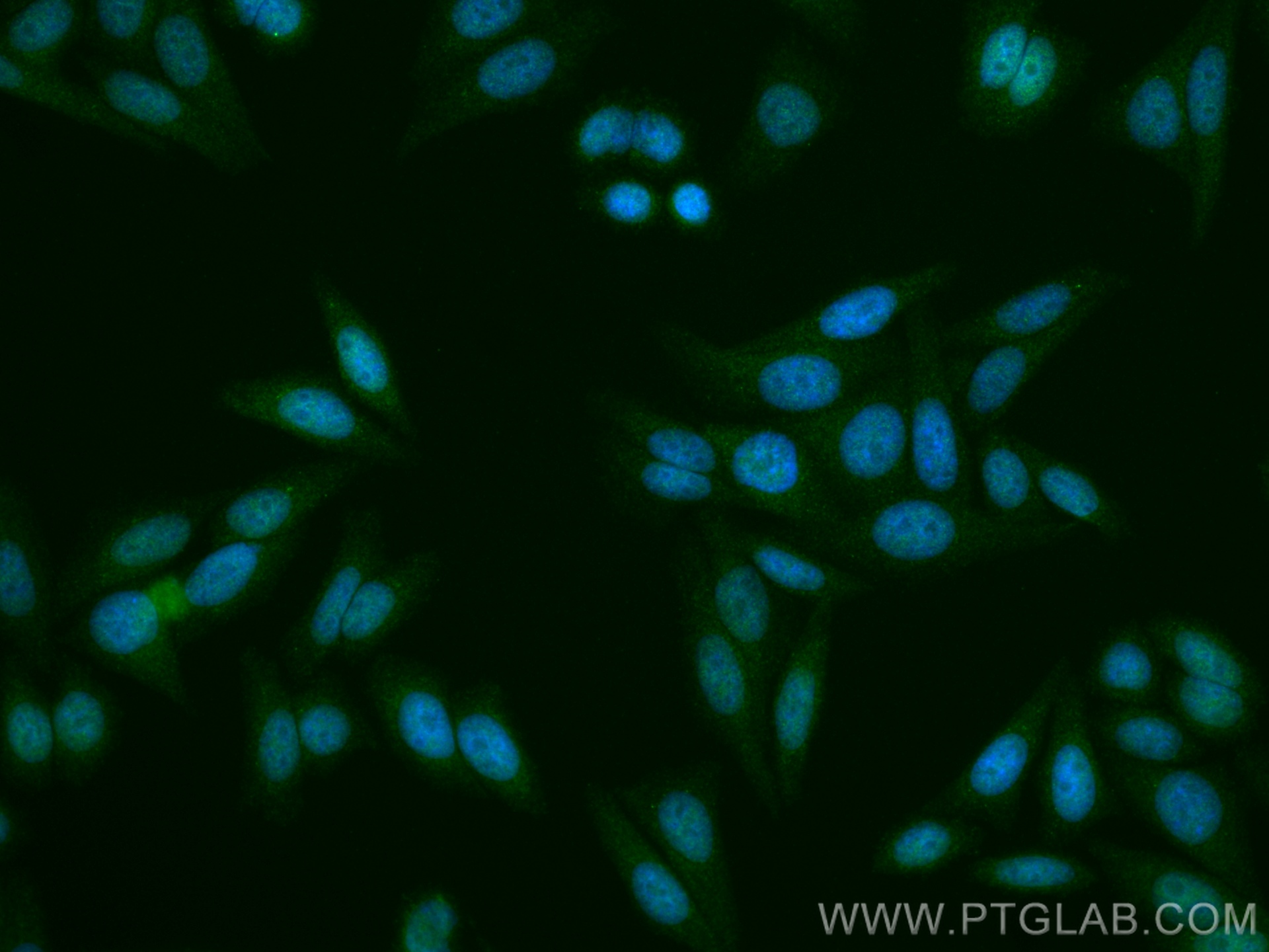 Immunofluorescence (IF) / fluorescent staining of HepG2 cells using ZNF654 Polyclonal antibody (24596-1-AP)