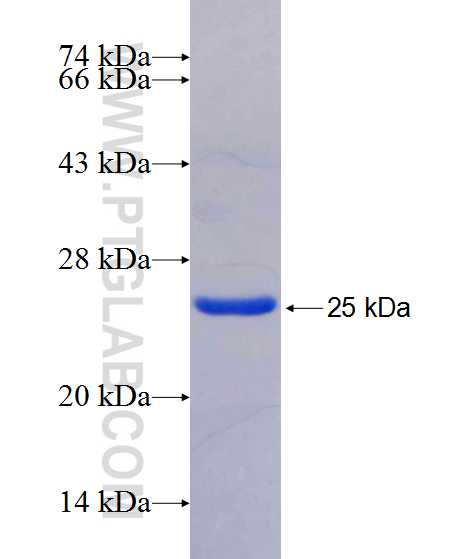 ZNF658 fusion protein Ag20520 SDS-PAGE