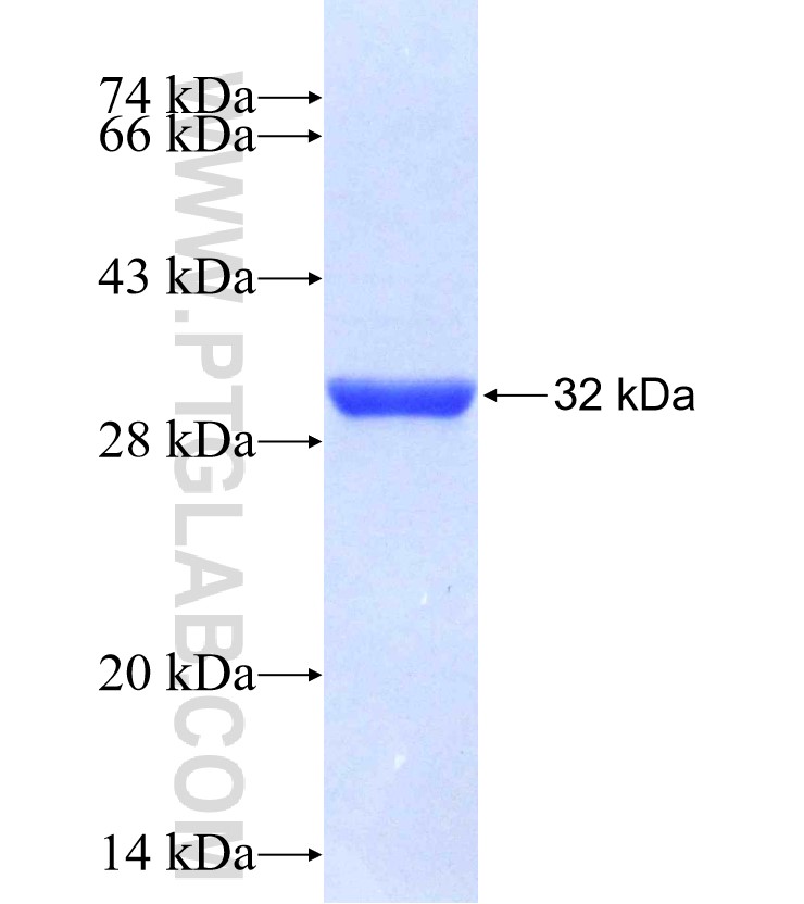 ZNF664 fusion protein Ag30992 SDS-PAGE