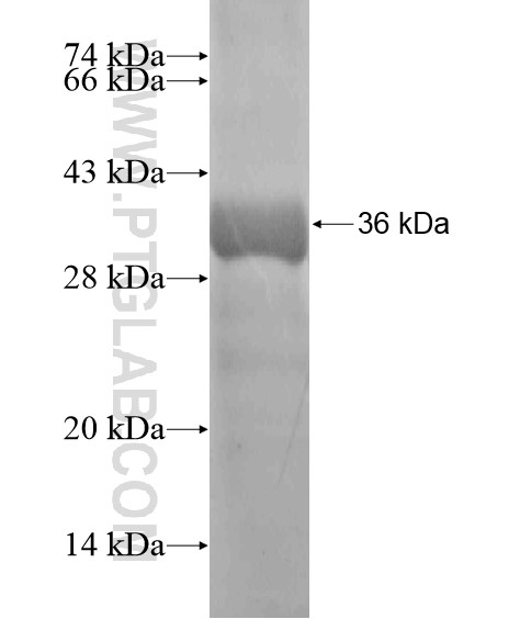 ZNF664 fusion protein Ag20104 SDS-PAGE