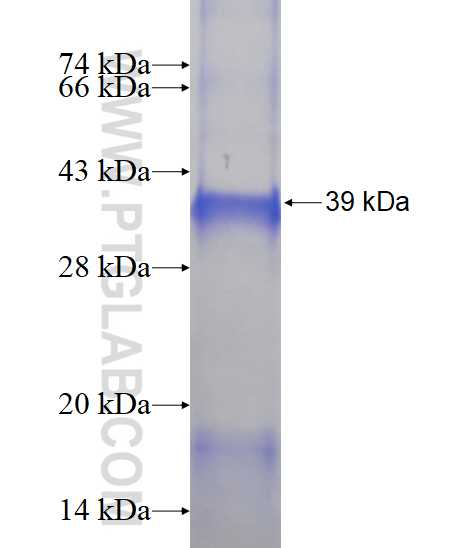 ZNF671 fusion protein Ag15319 SDS-PAGE