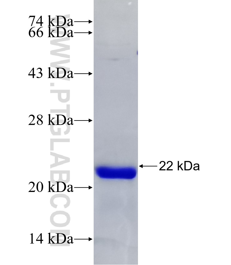 ZNF689 fusion protein Ag22307 SDS-PAGE