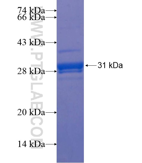 ZNF695 fusion protein Ag22202 SDS-PAGE