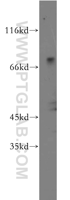 Western Blot (WB) analysis of human brain tissue using ZNF699 Polyclonal antibody (21562-1-AP)