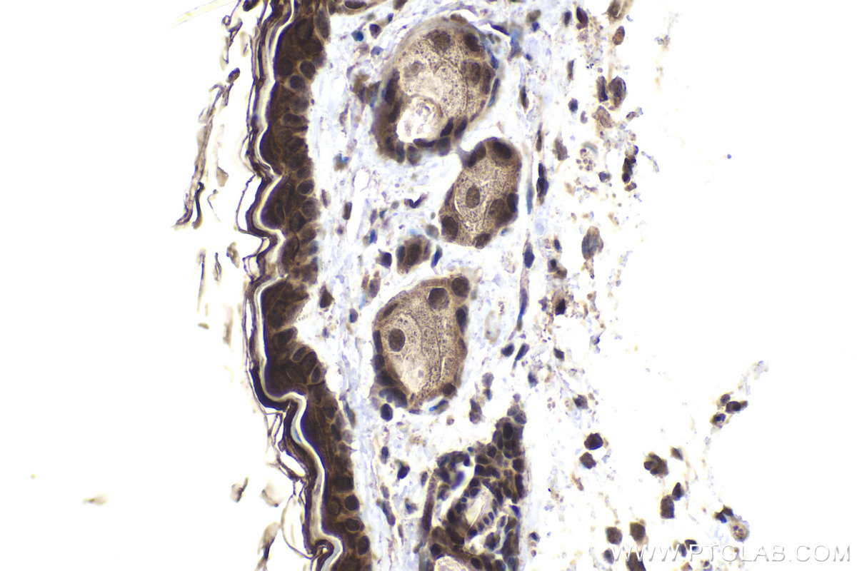 Immunohistochemistry (IHC) staining of mouse skin tissue using ZNF703 Polyclonal antibody (21075-1-AP)