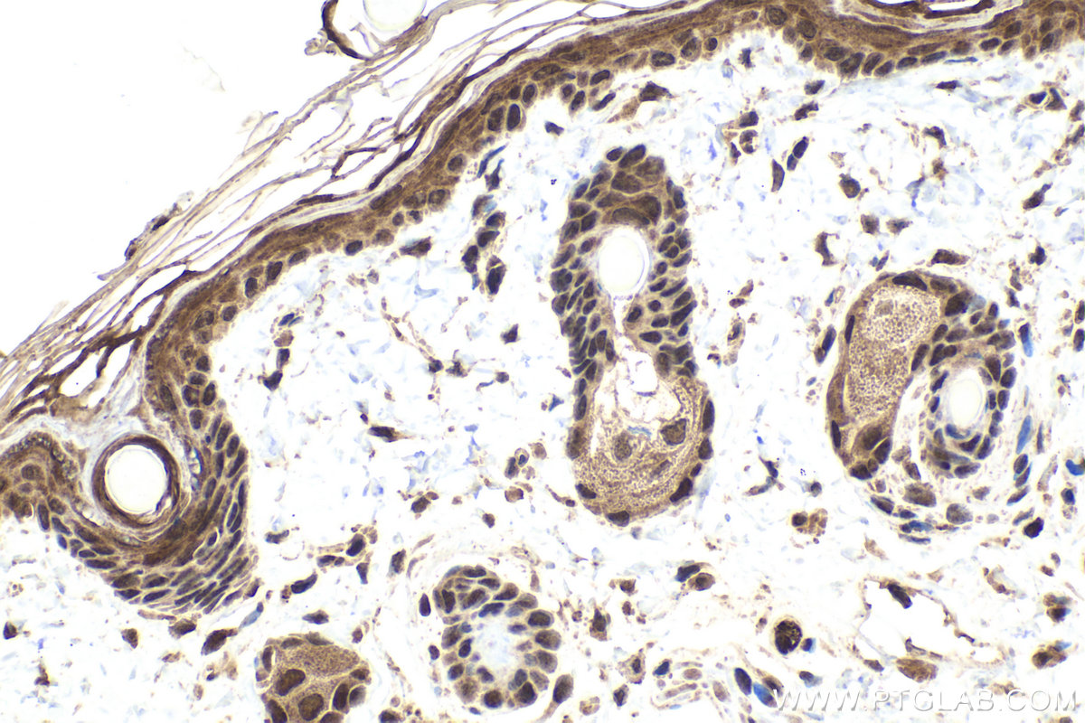 Immunohistochemistry (IHC) staining of rat skin tissue using ZNF703 Polyclonal antibody (21075-1-AP)