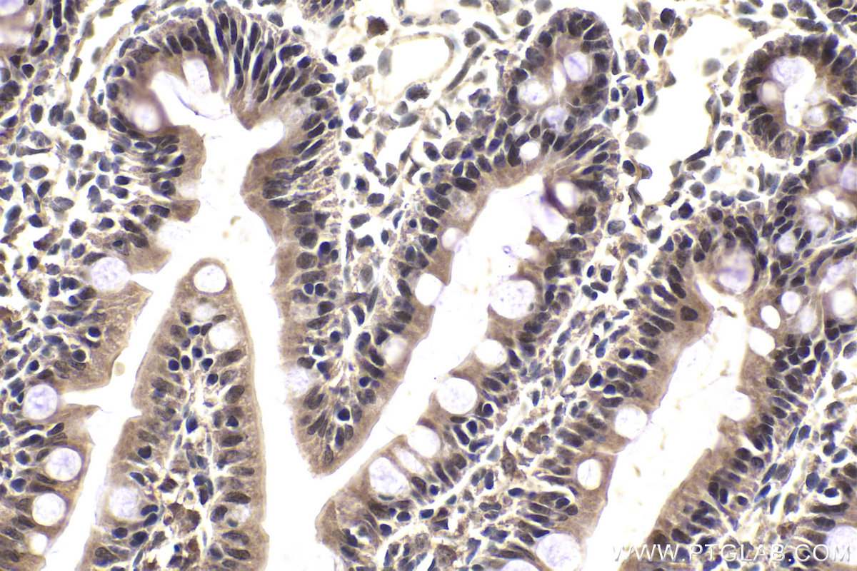 Immunohistochemistry (IHC) staining of rat small intestine tissue using ZNF703 Polyclonal antibody (21075-1-AP)