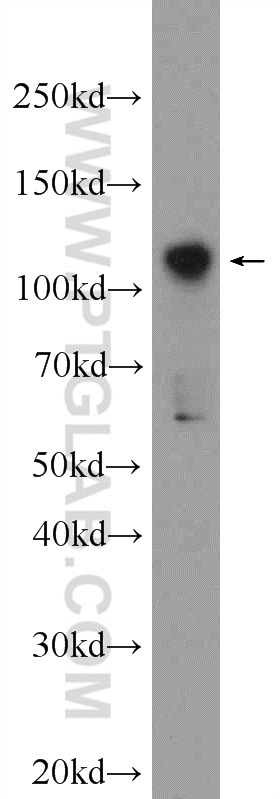 Western Blot (WB) analysis of Jurkat cells using ZNF711 Polyclonal antibody (25166-1-AP)