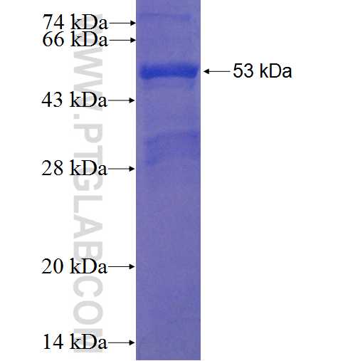 ZNF713 fusion protein Ag22349 SDS-PAGE