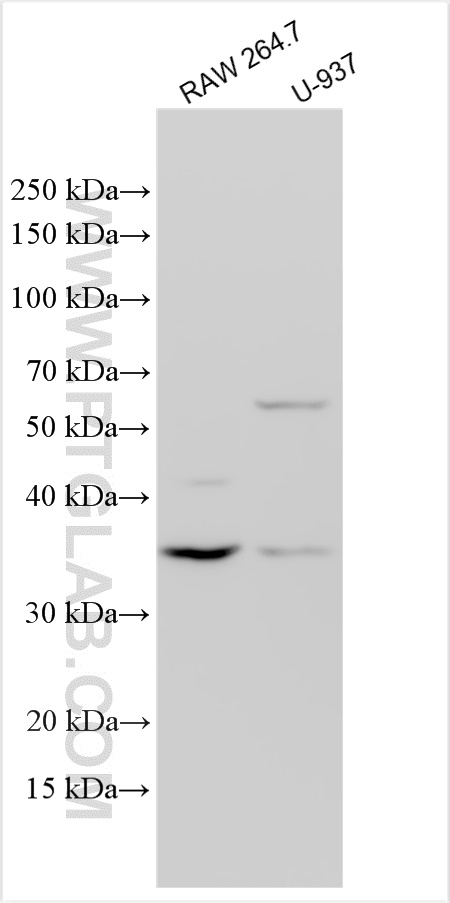 ZNF75D