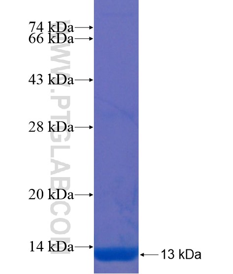 ZNF783 fusion protein Ag21792 SDS-PAGE