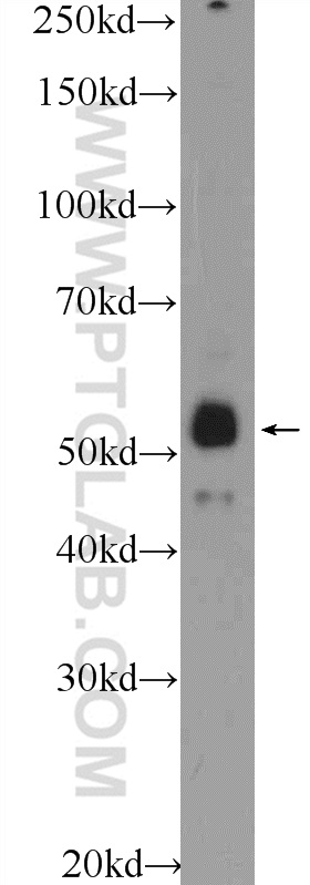 Western Blot (WB) analysis of HeLa cells using ZNF785 Polyclonal antibody (25588-1-AP)