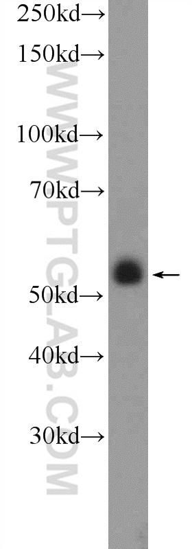 Western Blot (WB) analysis of HeLa cells using ZNF785 Polyclonal antibody (25588-1-AP)