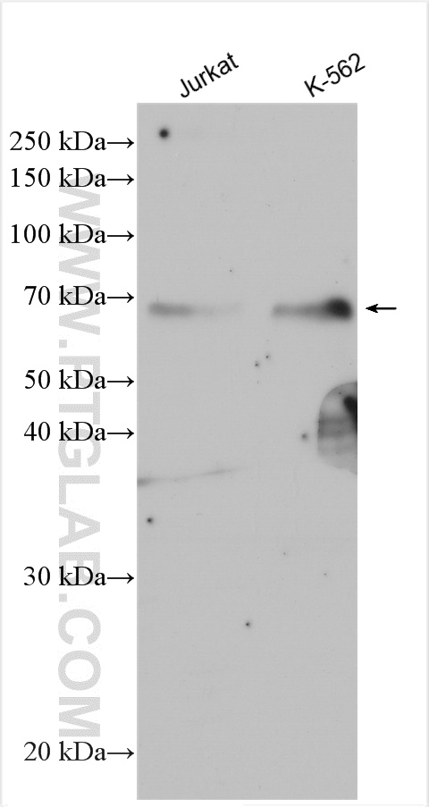 Western Blot (WB) analysis of various lysates using ZNF8 Polyclonal antibody (17448-1-AP)