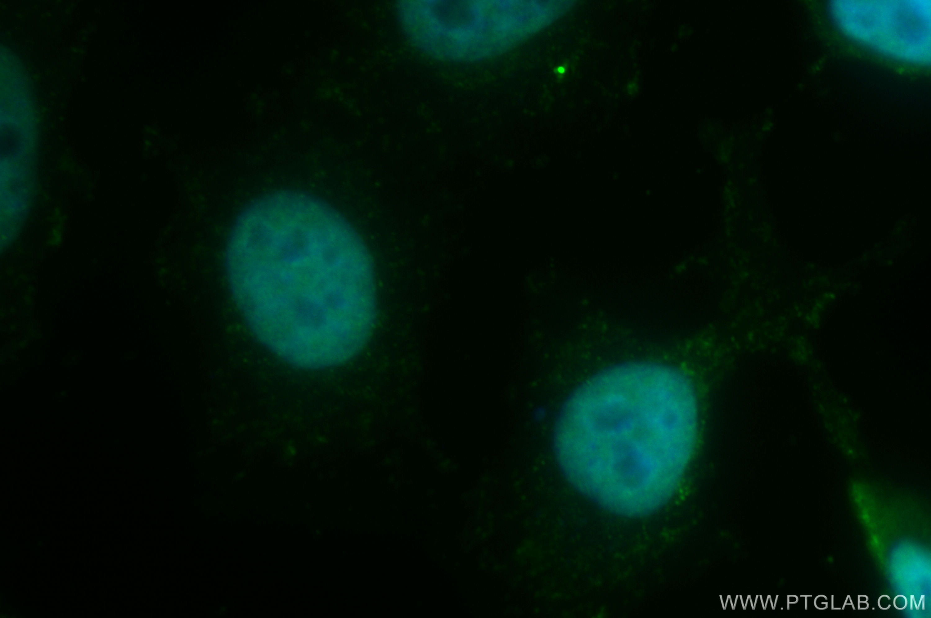 Immunofluorescence (IF) / fluorescent staining of HeLa cells using ZNF828 Polyclonal antibody (26315-1-AP)