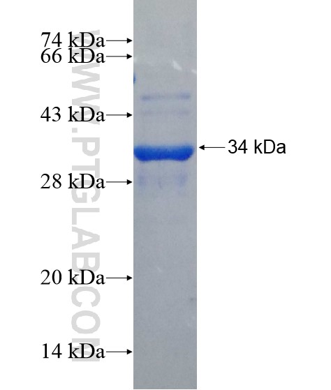 ZNRF4 fusion protein Ag22149 SDS-PAGE