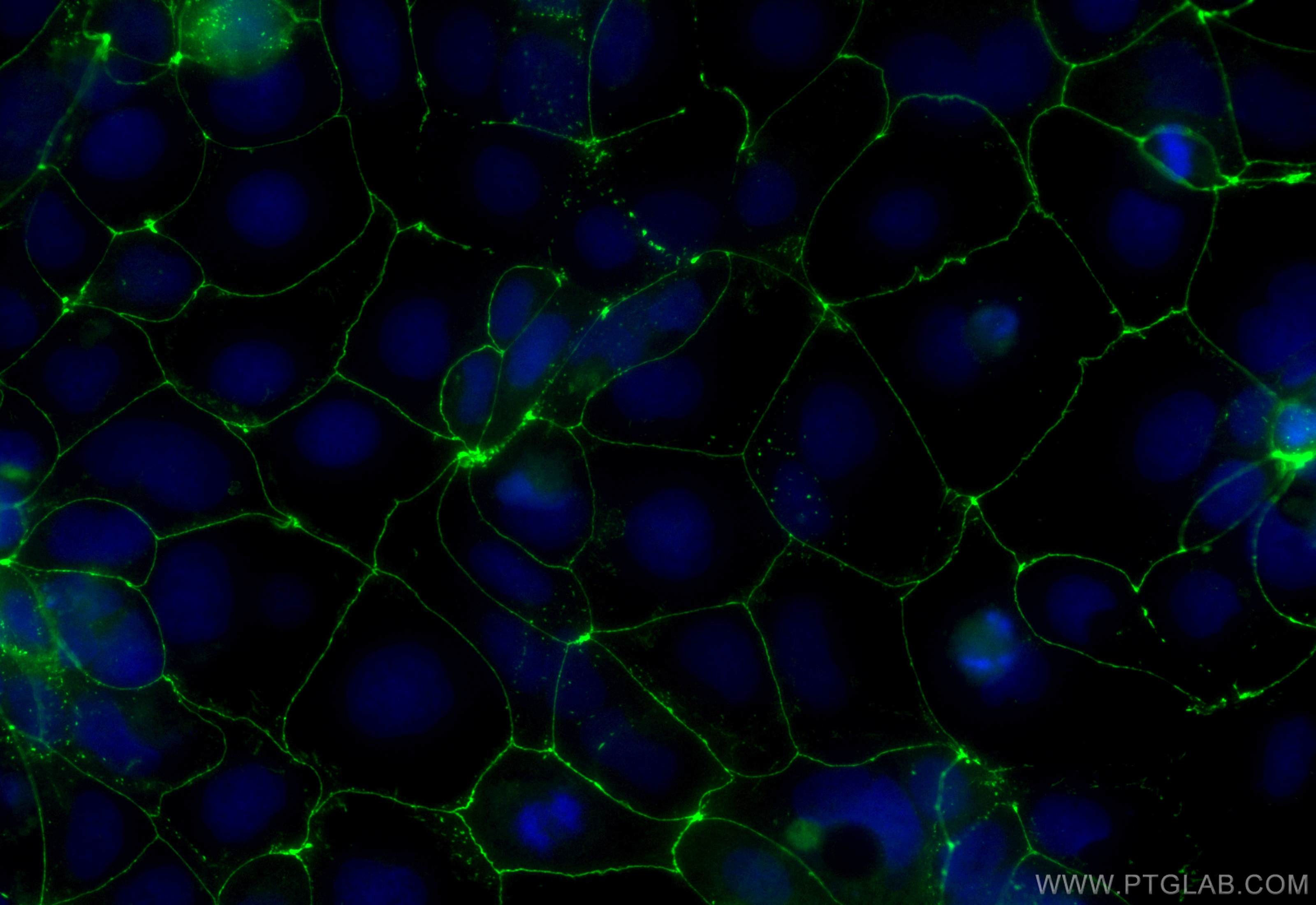 Immunofluorescence (IF) / fluorescent staining of Caco-2 cells using CoraLite® Plus 488-conjugated ZO-1 Recombinant ant (CL488-82870-7)