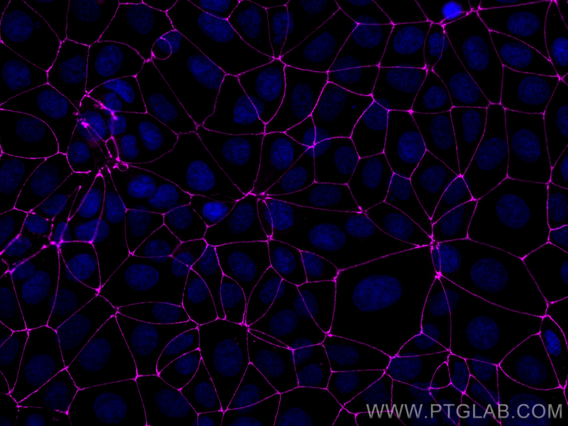 Immunofluorescence (IF) / fluorescent staining of MCF-7 cells using CoraLite® Plus 647-conjugated ZO-1 Recombinant ant (CL647-82870-7)