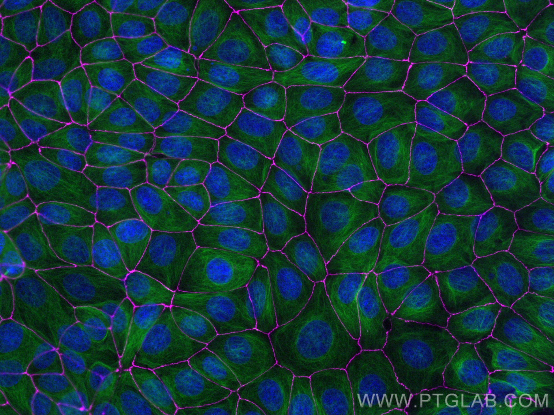 Immunofluorescence (IF) / fluorescent staining of MCF-7 cells using CoraLite® Plus 647-conjugated ZO-1 Recombinant ant (CL647-82870-7)
