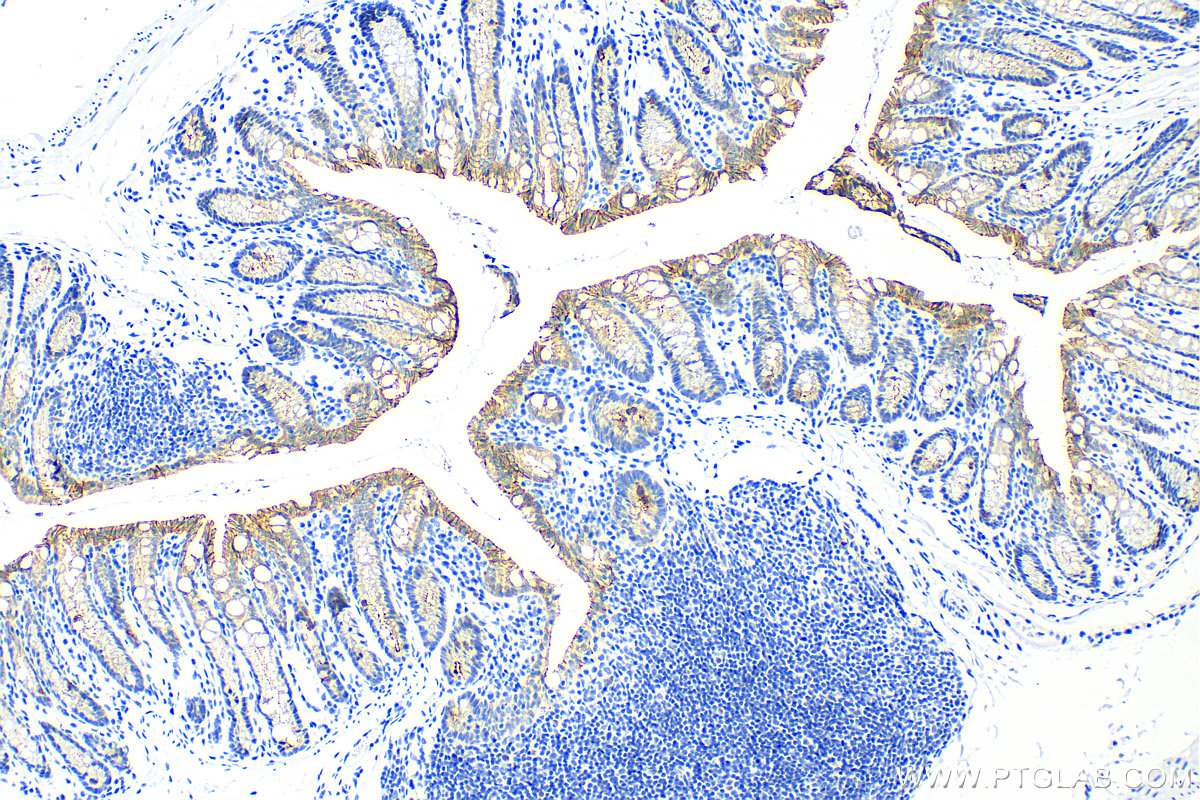 Immunohistochemistry (IHC) staining of mouse colon tissue using ZO-2 Recombinant antibody (83111-1-RR)