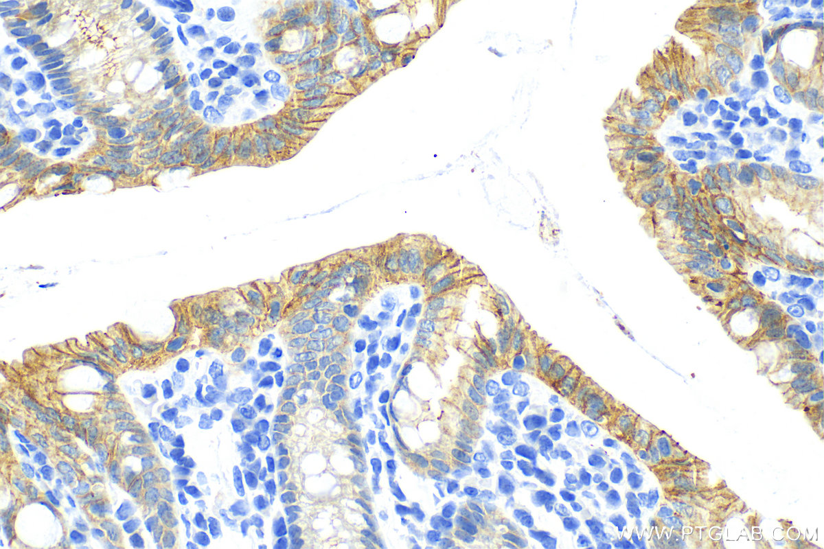 Immunohistochemistry (IHC) staining of mouse colon tissue using ZO-2 Recombinant antibody (83111-1-RR)
