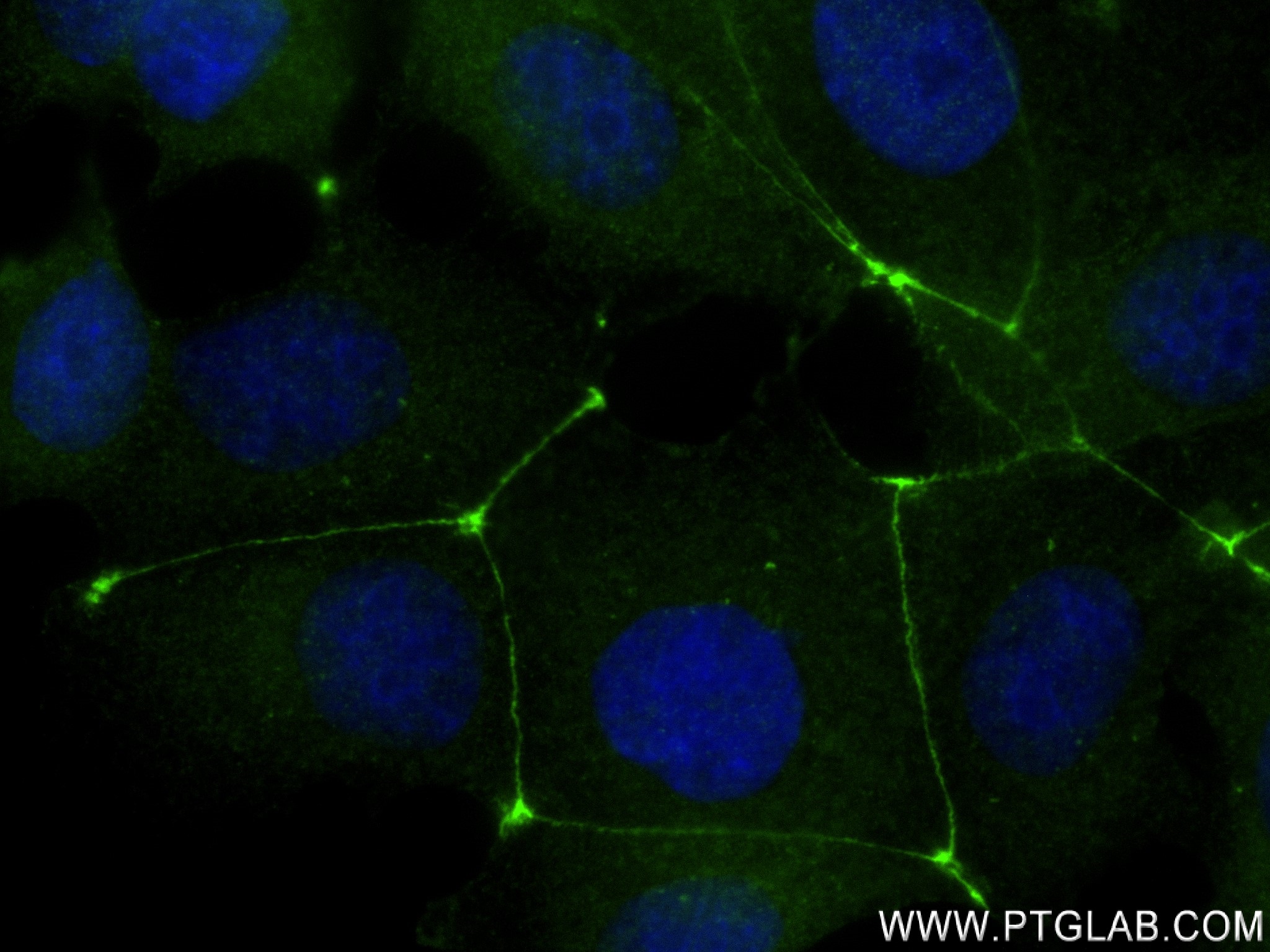 Immunofluorescence (IF) / fluorescent staining of MCF-7 cells using ZO-2 Recombinant antibody (83111-4-RR)