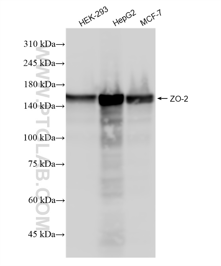 Western Blot (WB) analysis of various lysates using ZO-2 Recombinant antibody (83111-4-RR)