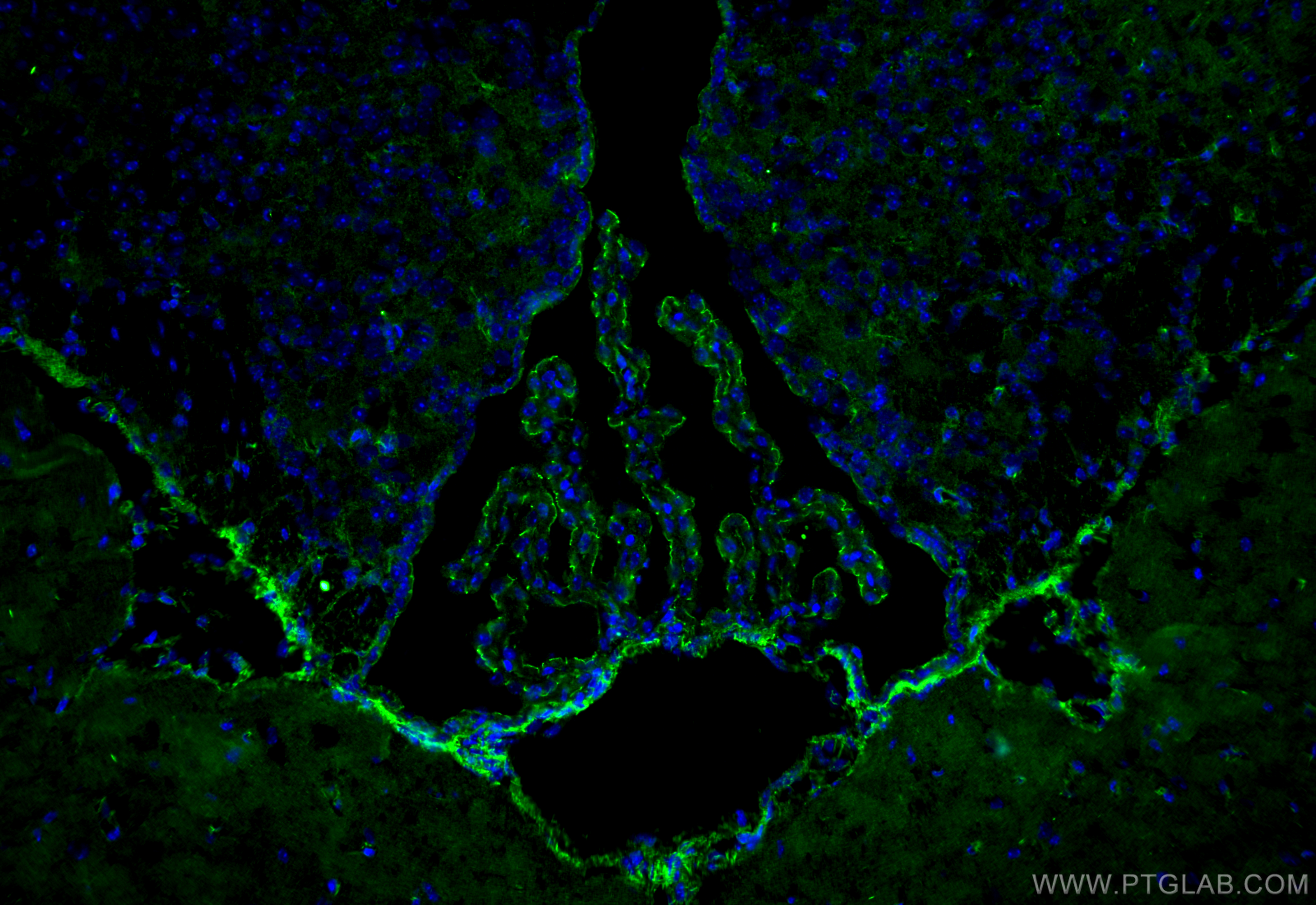 Immunofluorescence (IF) / fluorescent staining of mouse brain tissue using ZO-1 Polyclonal antibody (21773-1-AP)