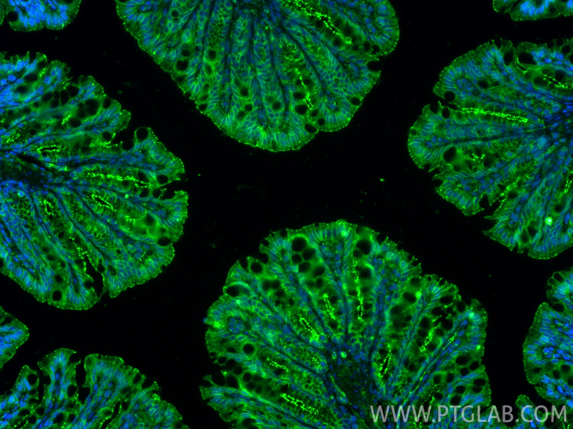 Immunofluorescence (IF) / fluorescent staining of mouse colon tissue using ZO-1 Polyclonal antibody (21773-1-AP)
